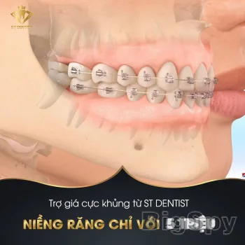 View More Trung Tâm Nha Khoa Thẩm Mỹ ST Dentist Ads On BigSpy