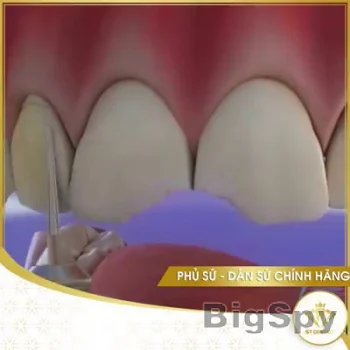 View More Trung Tâm Nha Khoa Thẩm Mỹ ST Dentist Ads On BigSpy