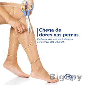 View More Homepage - CEP Varizes Ads On BigSpy
