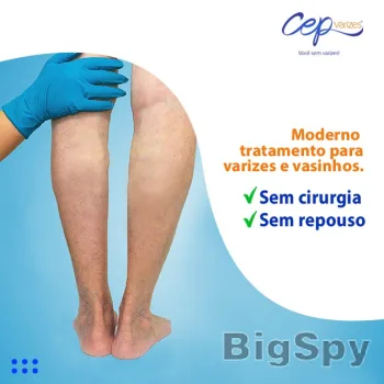 View More Homepage - CEP Varizes Ads On BigSpy