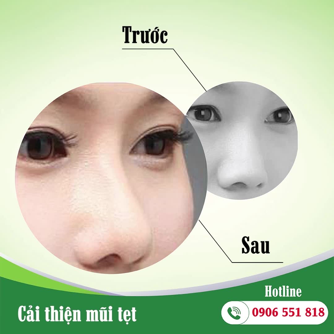 get_the_best_Clear Medical Face Masks_ad