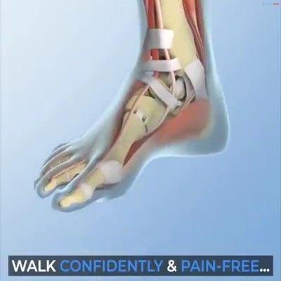 get_the_best_Athletes Foot_ad