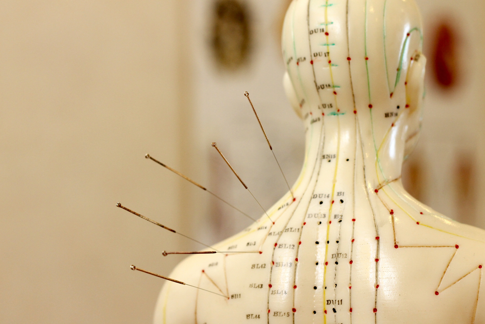 get_the_best_Acupuncture_ad