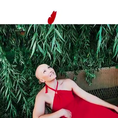 get_the_best_Alopecia Areata_ad