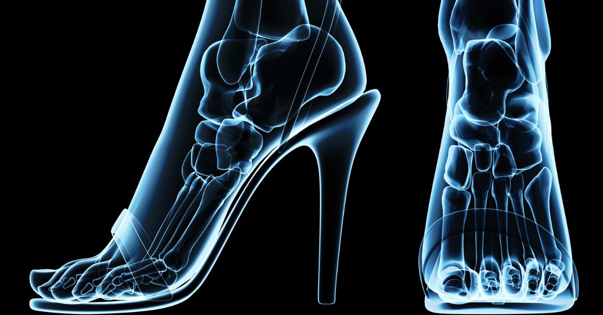 get_the_best_Achilles Tendon_ad