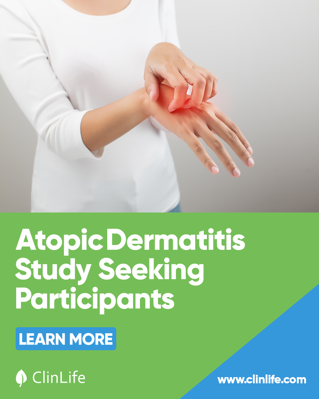 get_the_best_Atopic Dermatitis_ad