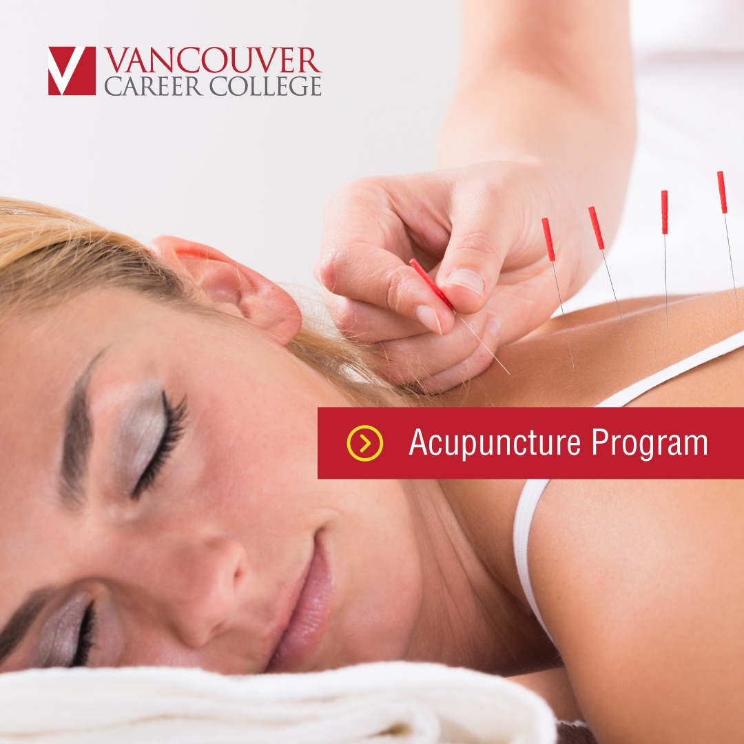 get_the_best_Acupuncture_ad