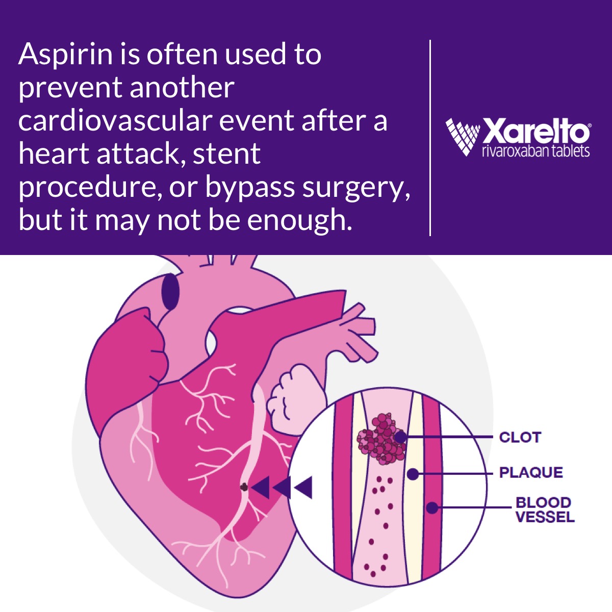 get_the_best_Aspirin_ad
