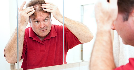 get_the_best_Alopecia Areata_ad