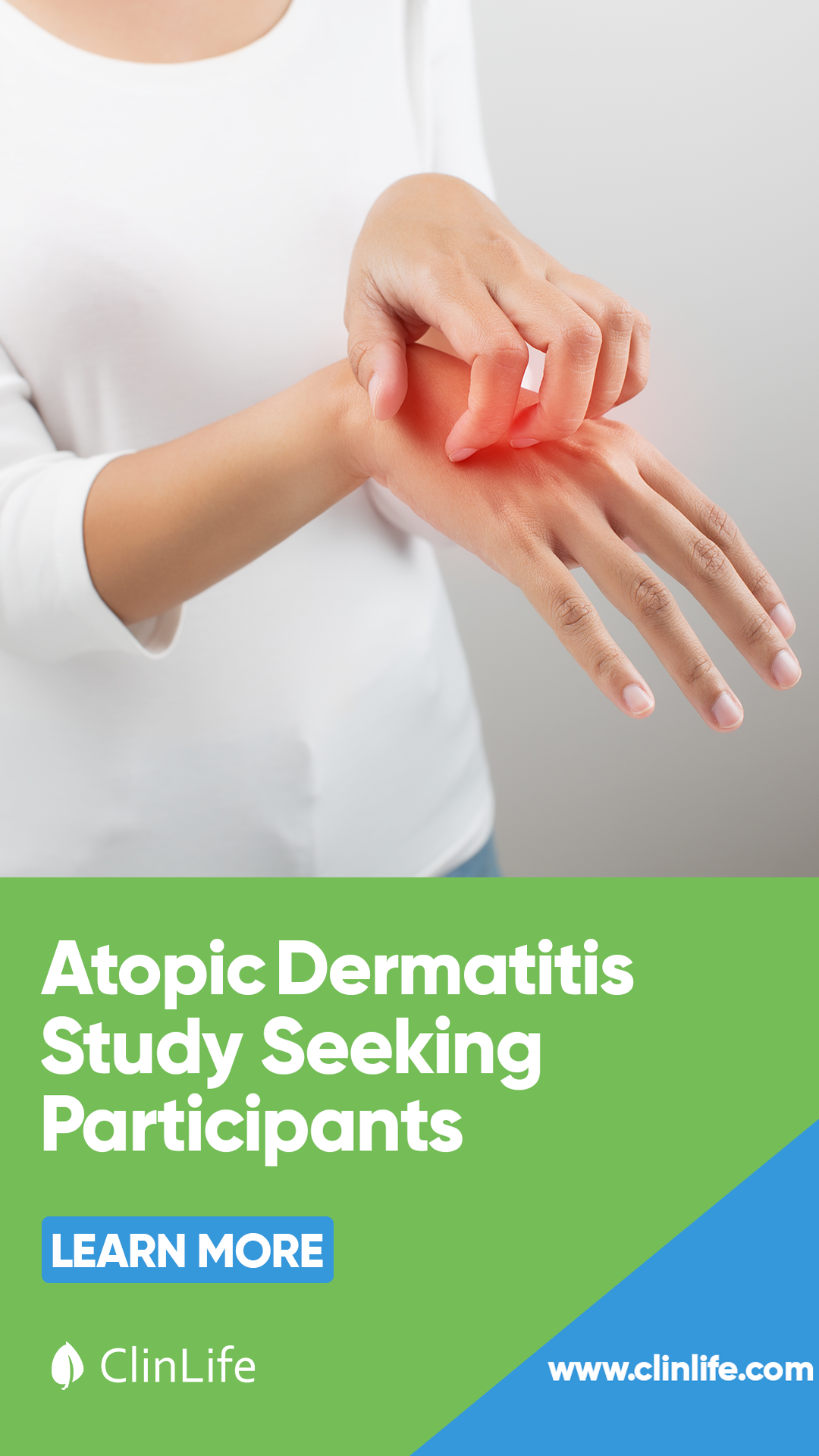 get_the_best_Atopic Dermatitis_ad
