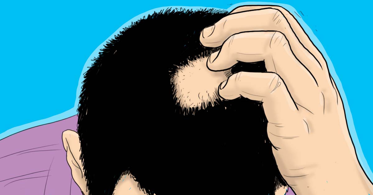 get_the_best_Alopecia Areata_ad